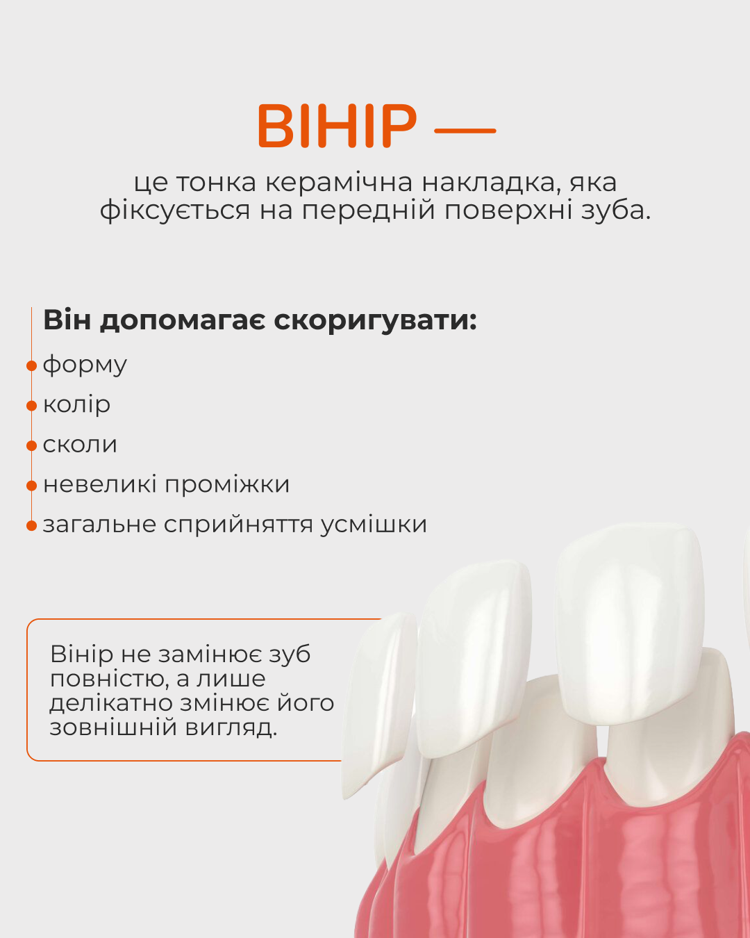Вініри