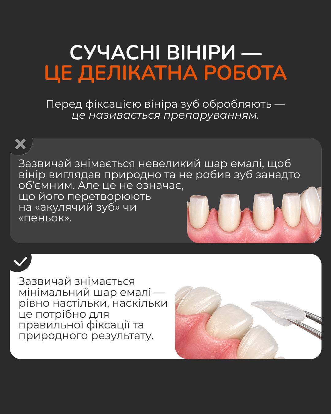 Вініри