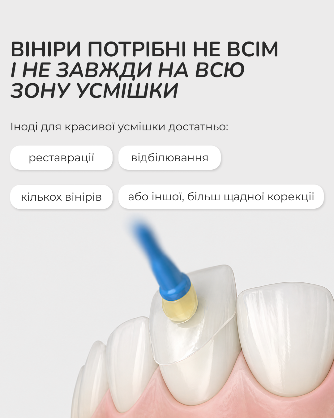 Вініри
